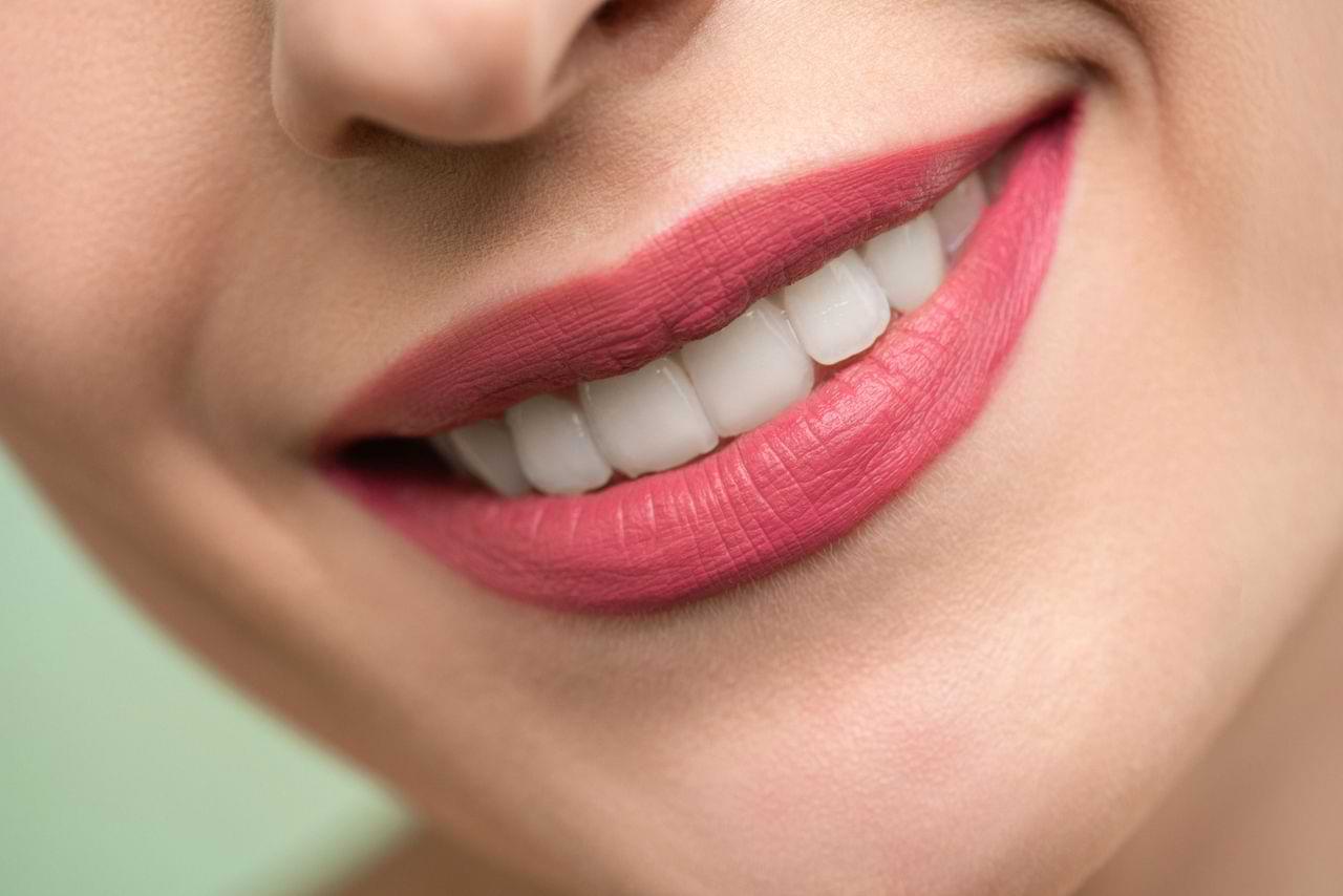 Fast Smile Makeovers For Summer Events